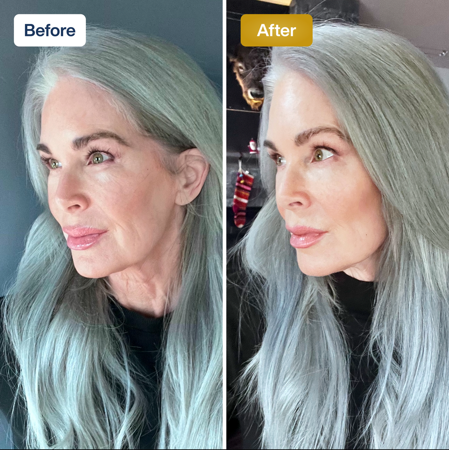 SkinKlean© Baby Collagen Face Mask
