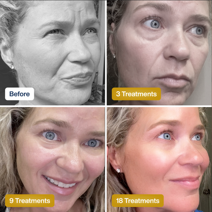 SkinKlean© Baby Collagen Face Mask