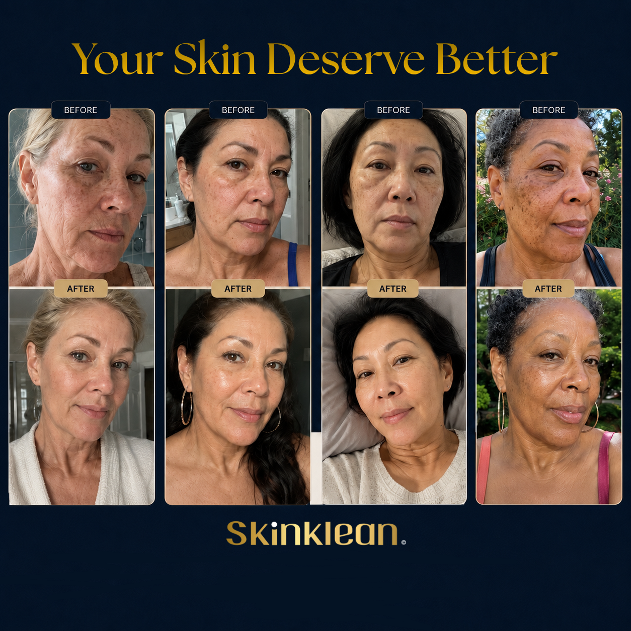Baby Collagen FACE Mask – SkinKlean