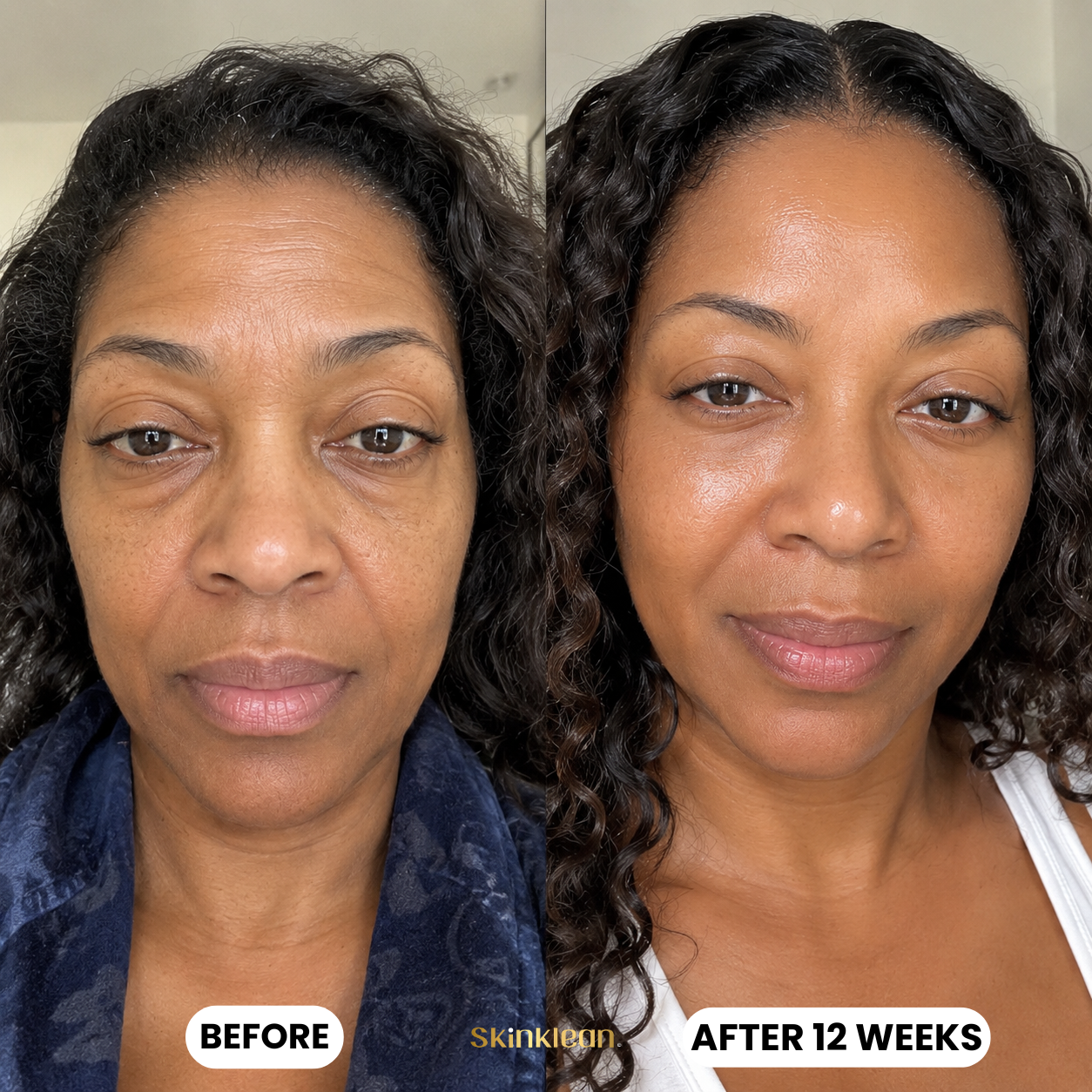 Baby Collagen FACE Mask – SkinKlean